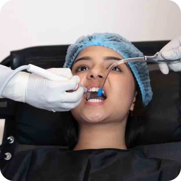 Mild Plaque Removal